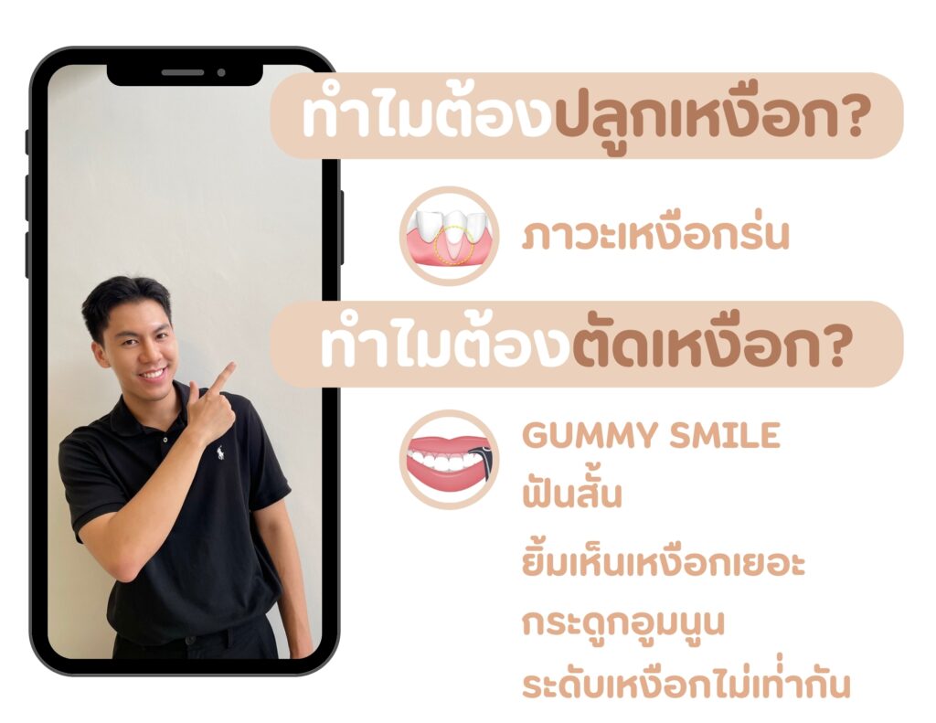 ทำไมต้องปลูกเหงือก