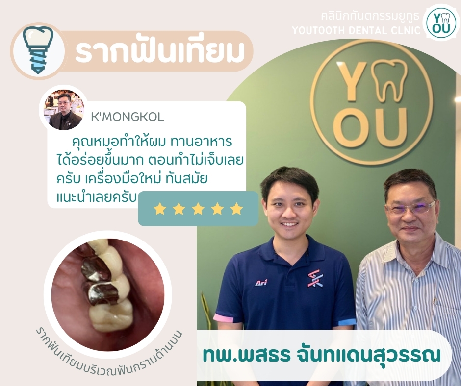รีวิวรากฟันเทียม