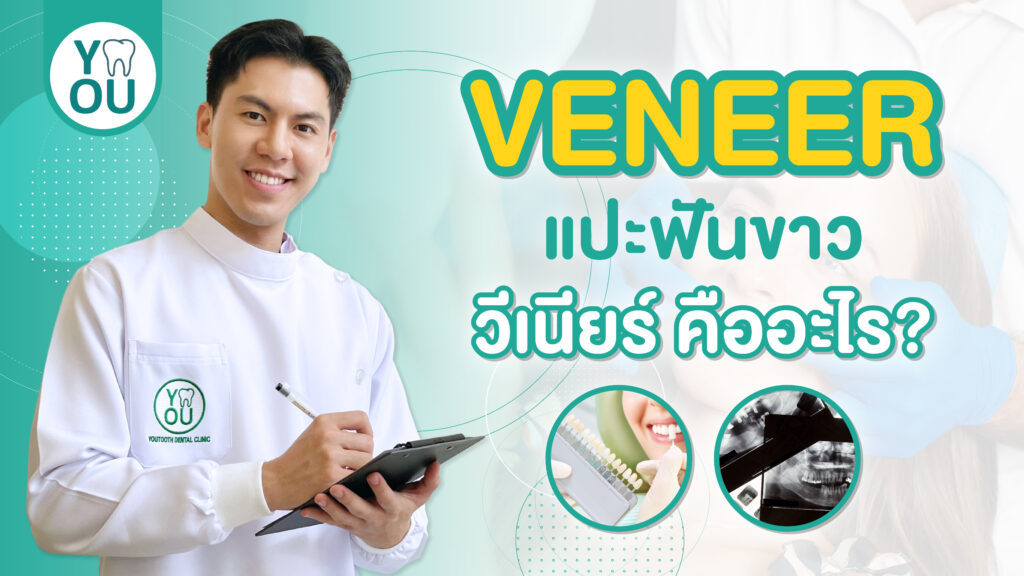 วีเนียร์ ราคา